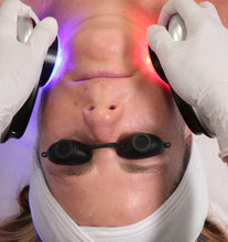 Load image into Gallery viewer, Platinum HydraFacial (In-office treatment, Product not shipped)