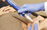 SkinPen NO PRP Face